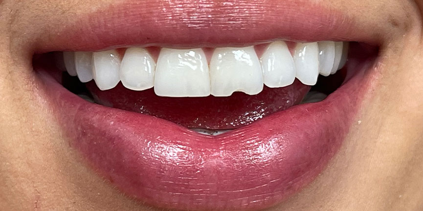 Smile Gallery