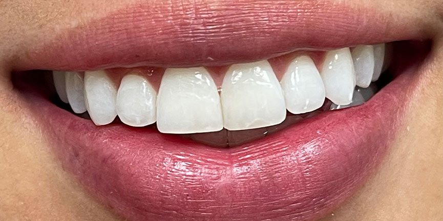 Smile Gallery