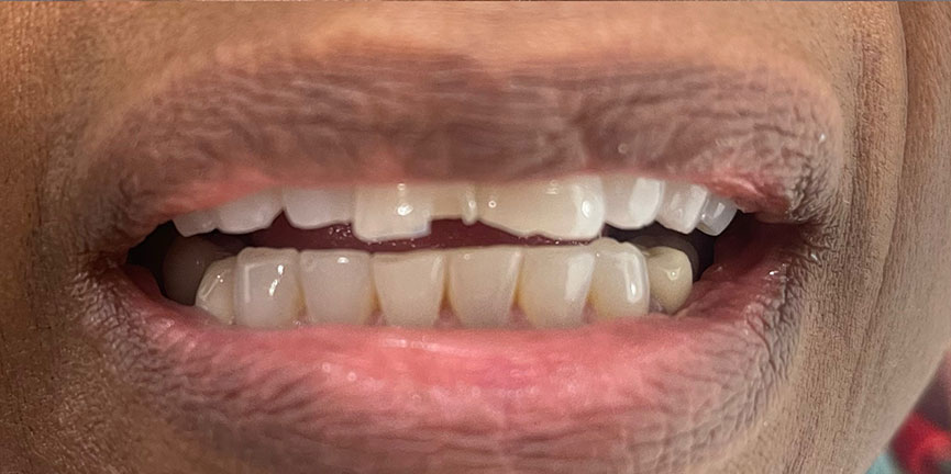 Smile Gallery