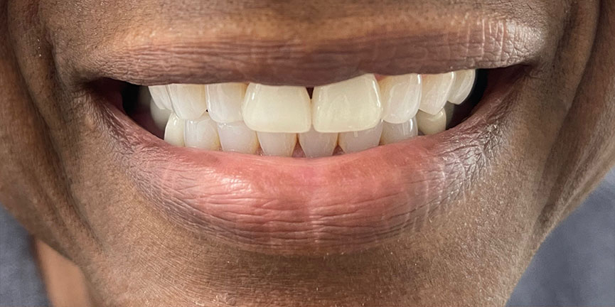Smile Gallery