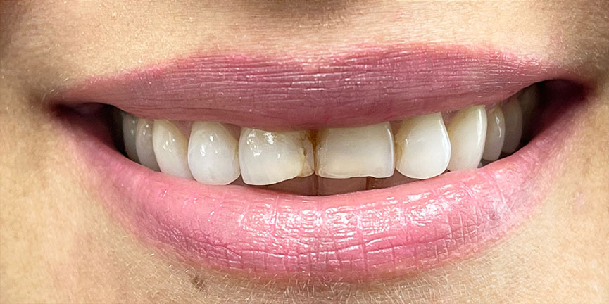 Smile Gallery