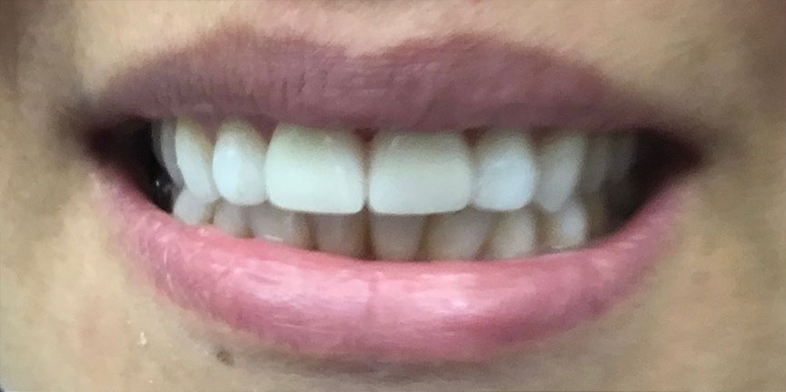 Smile Gallery