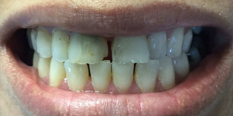 Smile Gallery