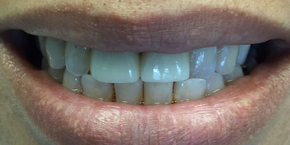 Smile Gallery