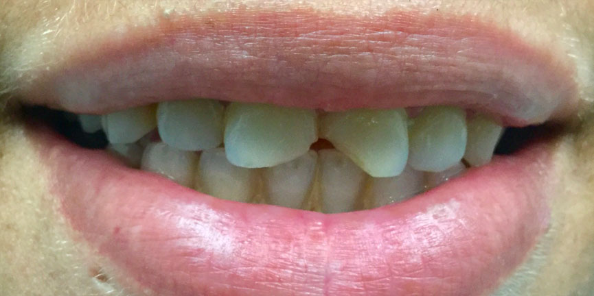 Smile Gallery