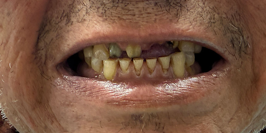 Smile Gallery