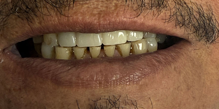 Smile Gallery